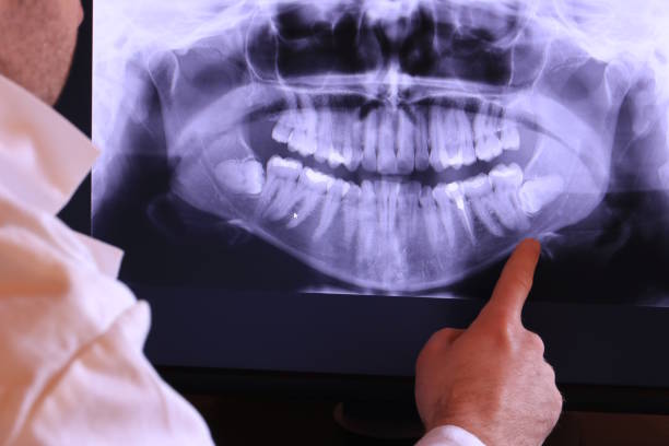 Best Emergency Dental Care for Broken or Chipped Teeth in Genoa, AR